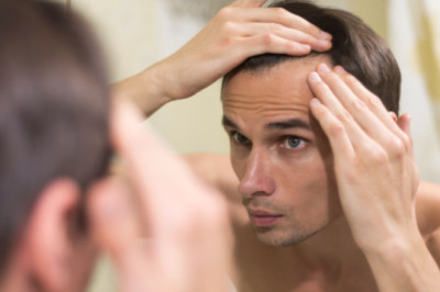 Understanding Male Pattern Hair Loss: Modern Solutions for a Common Concern